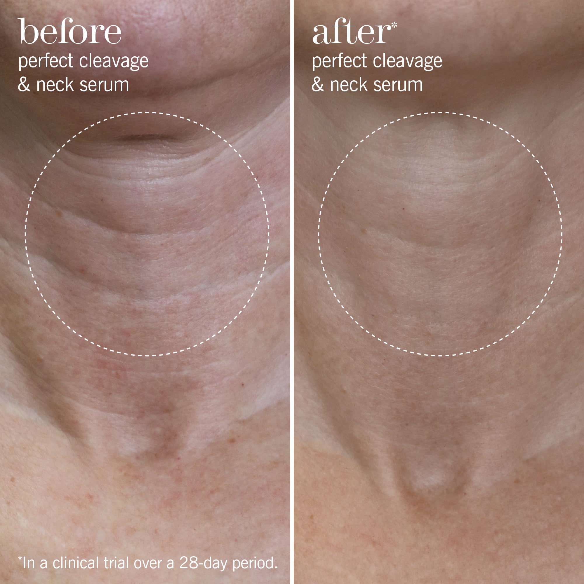 perfect cleavage & neck serum