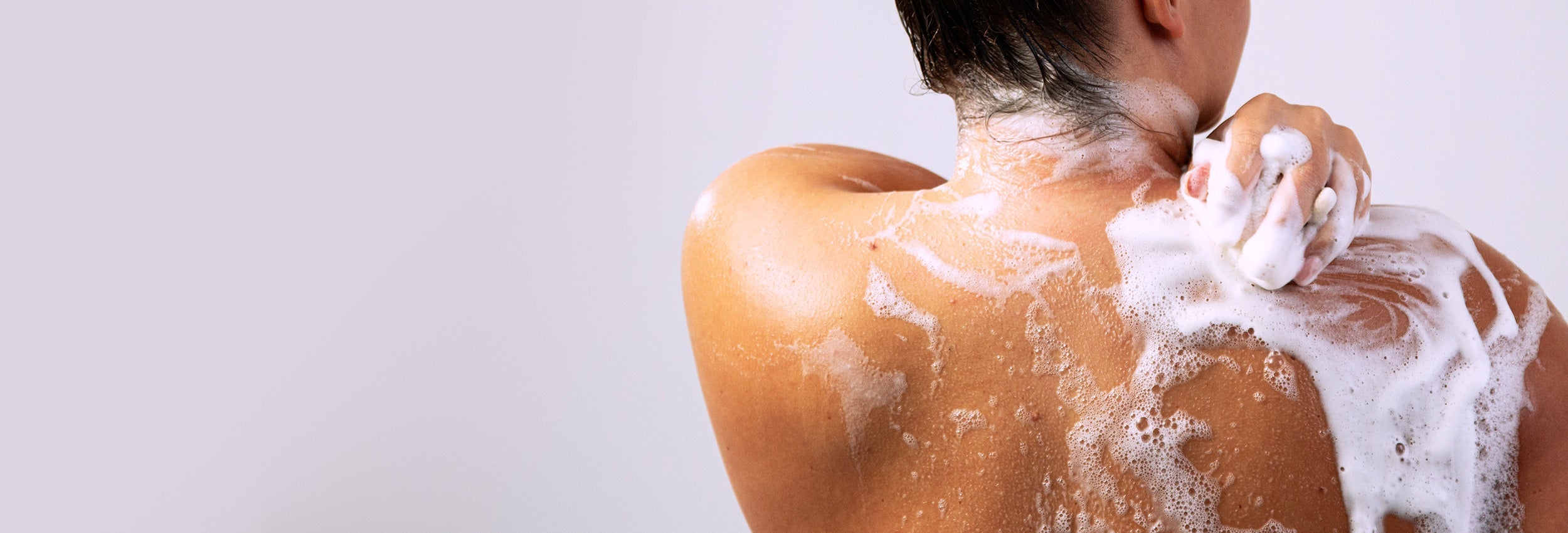 body blemishes